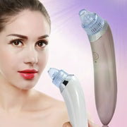 Blackhead Remover Vacuum Acne Cleaner – Deep Pore Cleansing for Flawless Skin